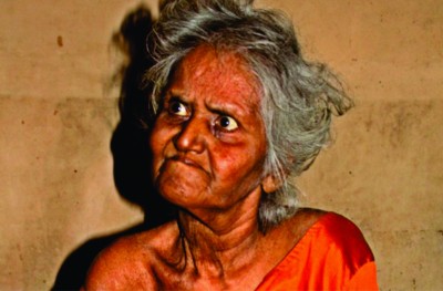 ކޮއްކޮގެ ކުނިވެފައިވާ ހަށިގަނޑާ އެކު ހަތަރު ދުވަސް