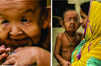 މިއީ ހަތަރު އަހަރުގެ ކުއްޖެއް، މުސްކުޅިއެއް ނޫން