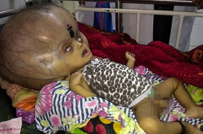 އާދަޔާޚިލާފަށް ބޯ ބޮޑު ކުއްޖާ އޮޕަރޭޝަން ކޮށްފި