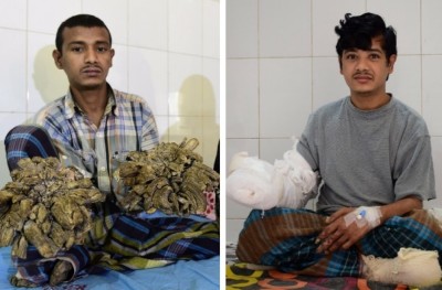 ބަންގްލަދޭޝްގެ "ގަސް މީހާ" އަށް މިހާރު ދަރިފުޅު އުރާލެވޭ