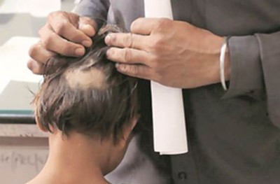 ފީ ނުދައްކައިގެން ދަރިވަރެއްގެ އިސްތަށިގަނޑުން ބައެއް އުފުރާލައިފި