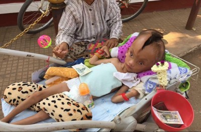 ކުއްޖެއްގެ ބޯ ދެފަޅިވަނީ