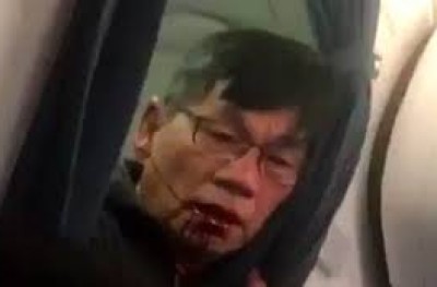 ގަދަކަމުން ބޯޓުން ބޭލި މީހާގެ ދެ ދަތާއި ނޭފަތް ވަނީ ބިނދިފައި