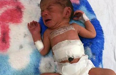 ކުއްޖެއްގެ ބަނޑުން ނުކުމެފައި އިން ބޮލެއް ވަކިކޮށްފި