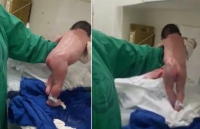 އުފަންވުމާ އެކު ކުއްޖަކު "ހިނގަން ފަށައިފި"