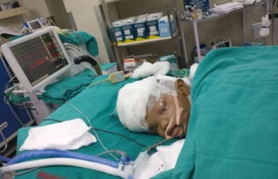 ބޮލުން ގުޅިފައިވާ ދެ ކުދިން އިންޑިއާގެ ޑޮކްޓަރުން ވަކިކޮށްފި