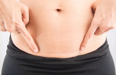 ސިޒޭރިއަން ހަދަން ފަޅާ ތަނުގެ ދިގުމިނާއި ފަހުން ވާ ތަދާ ގުޅުމެއްވޭ