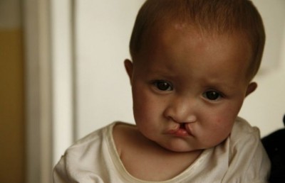 ކުޑަކުދިންނަށް ހިިނިތުންވުން ގެނެސްދޭ ޑޮކްޓަރު