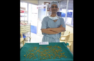 އިންޑިއާ އަންހެނެއްގެ ގޮހޮރުން 2،000 އަށް ވުރެ ގިނަ ހިލަކޮޅު ނަގައިފި