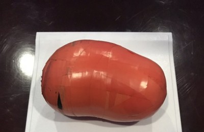 އައްޑު އަށް މަސްތުވާތަކެތި އެތެރެކުރި ކުއްޖަކު ހައްޔަރުކޮށްފި