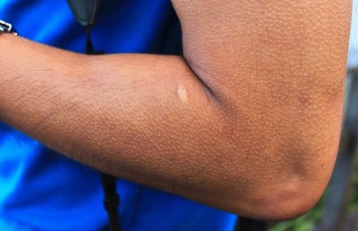 ހީބިހި ނެގުމަކީ ދުޅަހެޔޮކަމުގެ ނިޝާނެއް