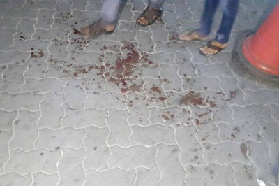 ރޭގެ މާރާމާރީއާ ގުޅިގެން ކުޑަ ދެ ކުދިންނާއި މީހަކު ހައްޔަރުކޮށްފި