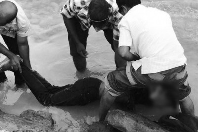 ކައްދޫ އެކްސިޑެންޓުގައި އަނިޔާވި އެކެއްގެ ފައި ވަނީ ބިންދައިގެން ގޮސްފައި: އައިޖީއެމްއެޗް