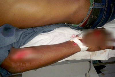 ތިނަދޫގައި ނުރައްކާތެރި އެކްސިޑެންޓެއް ހިނގައި ޒުވާނަކު ޒަހަމްވެއްޖެ