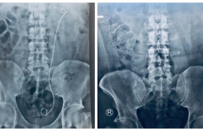 އޮޕަރޭޝަނަށް ފަހު އަދީބު ގެއަށް ބަދަލުކުރަން ވަނީ ލަފާދީފައި: އާއިލާ