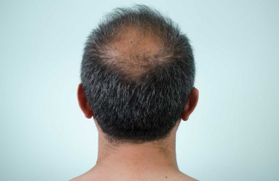 ތަލަވުމުގެ ފަރުވާއަކާ ހިސާބަށް ދެވިދާނެ ހޯދުމެއް