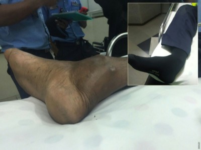 ފިލަން ދުއްވި ސައިކަލުން ޖެހި ފުލުސް މީހާގެ ފައި ވަނީ ބިދިފައި