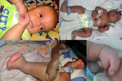 ތުއްތު އަލްޔާން، އައިބުތައް ފިލުވުމަށް އެހީއަކަށް އެދި