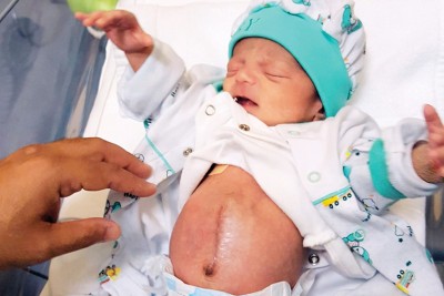 އުފަންވި އިރު ފުރަ މެއާއި ގޮހޮރު ބޭރުގައި އޮތް ކުއްޖެއްގެ ކާމިޔާބު އޮޕަރޭޝަނެއް ކޮށްފި