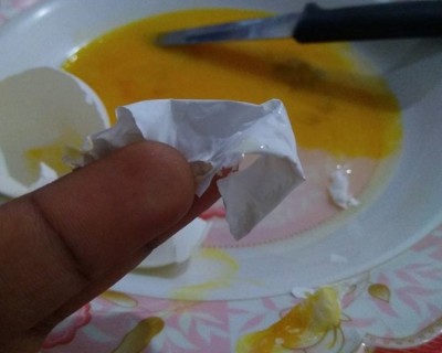 ބިހުގެ މައްސަލަ ބައިނަލްއަގްވާމީ ފަރާތަކުން ސަމާލުކަމަށް ގެނެސްފައެއް ނުވޭ: ހެލްތު މިނިސްޓްރީ