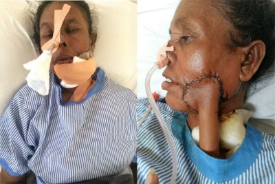 ކުޑަ ކަމެއްކަމަށް ބެލިކަންތައް، އެންމެ ފަހުން ކެންސަރަށް!