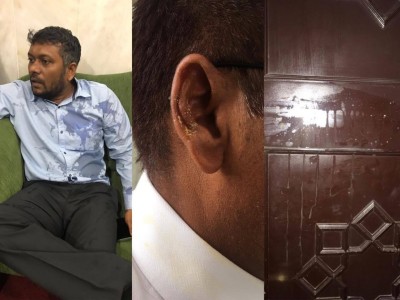 ބިސް ކަމަށް ޝައްކު ކުރެވޭ އެއްޗެއް މެންބަރު އައްސަދު ގެންގުޅޭ ވީޑިއޯއެއް އާންމުވެއްޖެ