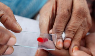 ލޭ ތިއްކަކުން ހަށިގަނޑުގައި ކެންސަރު ހުރިކަން ދެނެގެނެވޭނެ ޓެކްނޮލޮޖީއެއް ޖަޕާނުން އީޖާދުކޮށްފި