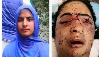 އިންޑިއާ ސިފައިން ކަޝްމީރުގައި ޕެލެޓްގަން ބޭނުންކުރުމާ ދެކޮޅަށް އެމްނިސްޓީން ކެމްޕޭނެއް ފަށައިފި