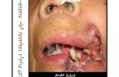 ދުންފަތާ ދެކޮޅު ނިންމުންތަކުން ރަނގަޅު ނަތީޖާއެއް ނުކުންނާނެ ކަމަށް އުއްމީދުކުރެވޭ: މިނިސްޓަރު