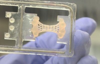 ހާޓް އެޓޭކާ ދެކޮޅަށް ހިތުގައި ޕެޗެއް