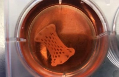 ހާޓް އެޓޭކާ ދެކޮޅަށް ހިތުގައި ޕެޗެއް