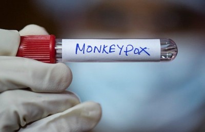 މަންކީޕޮކްސް: އިންޑިއާގެ ފުރަތަމަ ކޭސް އަދި މަރު ކެރެލާއިން