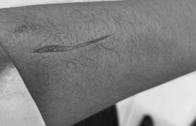 އަލީ ސޯލިހުގެ ގައިގައި ކަޓަރު އަޅައި ޒަހަމްކޮށްލައިފި