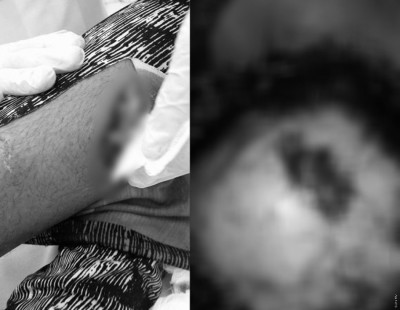 ނޮޅިވަރަންފަރު އެކްސިޑެންޓުގައި އަނިޔާވި މީހާ މާލެ ގެނެސްފި