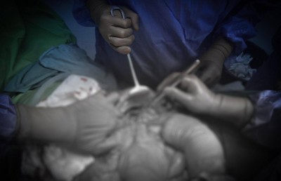 މާއުނގޫދޫ މާރާމާރީގައި ޒަހަމްވި ޒުވާނާގެ ފުރަތަމަ އޮޕަރޭޝަން ކާމިޔާބު