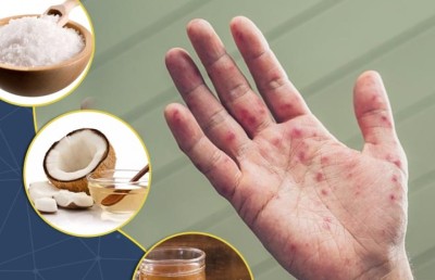 ހޭންޑް ފުޓް އެންޑް މައުތު: އިސްކުރަންވީ ތާހިރުކަން