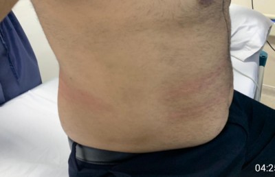 ޝިޔާމްގެ މައިބަދައިގައި ވަނީ ރެނދުލައިފައި: ޕީޕީއެމް