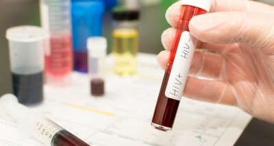 ޕާކިސްތާނުގައި 90 މީހުންނަށް އެޗްއައިވީ ޖެއްސި ޑޮކްޓަރު ހައްޔަރުކޮށްފި