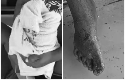 ކަންނެލި ދޯންޏަކުން މޫދަށް ވެއްޓުނު މީހަކަށް މިޔަރެއްގެ ނުރައްކާ ހަމަލާތަކެއް