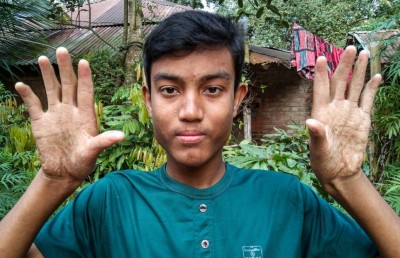 އިނގިލީގެ ނިޝާން ނުހުންނަ އާއިލާއެއް