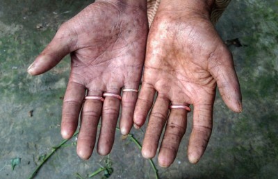 އިނގިލީގެ ނިޝާން ނުހުންނަ އާއިލާއެއް