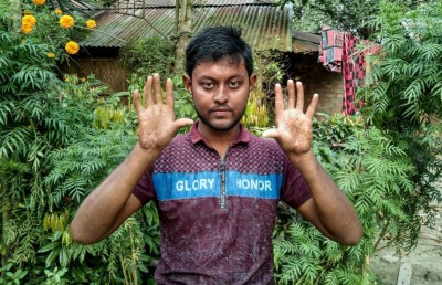 އިނގިލީގެ ނިޝާން ނުހުންނަ އާއިލާއެއް