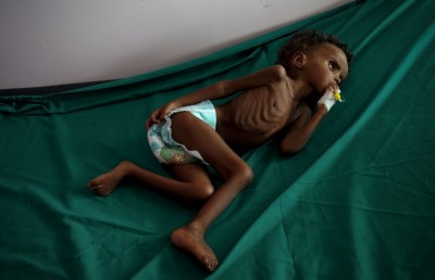 ކާޑުބަލީގެ ކުދިން މަރުވިޔަސް ނުރޯނެ