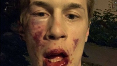 އިދިކޮޅު ލީޑަރަށް ފަހު، ރަޝިއާގެ އިދިކޮޅު ބްލޮގަރަކަށް ހަމަލާދީ ޒަހަމުކޮށްލައިފި