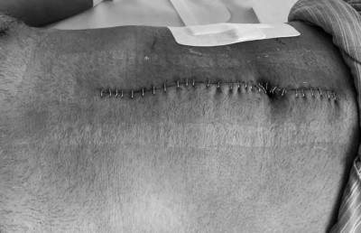 ހަމަލައިން ނަޝީދު ސަލާމަތް ވިޔަސް ނުރައްކާ ފިލައިގެނެއް ނުދޭ: މަޖިލީހުގެ އިދާރާ