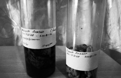 ފުވައްމުލަކުގައި ސިޒޭރިއަން ހެދި މީހެއްގެ ބަނޑުގައި ފޮތިގަނޑެއް، މިނިސްޓްރީން މައްސަލަ ބަލަނީ