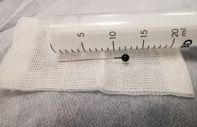 އަންހެން ކުއްޖެއްގެ ނޭވާހޮޅިން ބޮޑު ޕިނެއް ނަގައިފި