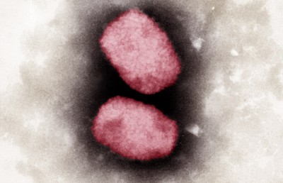 އެމްޕޮކްސްގެ ނުރައްކަލާ މެދު ޑަބްލިޔުއެޗްއޯއިން ގޮތެއް ނިންމަނީ