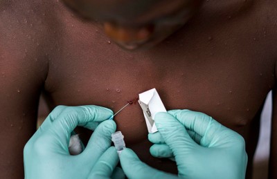 އެމްޕޮކްސްގެ ނުރައްކާ މުޅި ދުނިޔެ އަށް އޮތްކަން އިއުލާން ކުރުމުން ރާއްޖެއިން ރައްކާތެރިކަމުގެ ފިޔަވަޅު އަޅަނީ