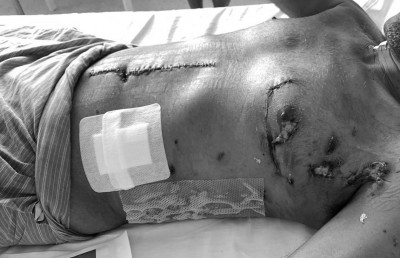 ހަމަލާއަށް ފަހު ނަޝީދުގެ "އެނބުރި އައުން" ފެންނަ ވީޑިއޯއެއް